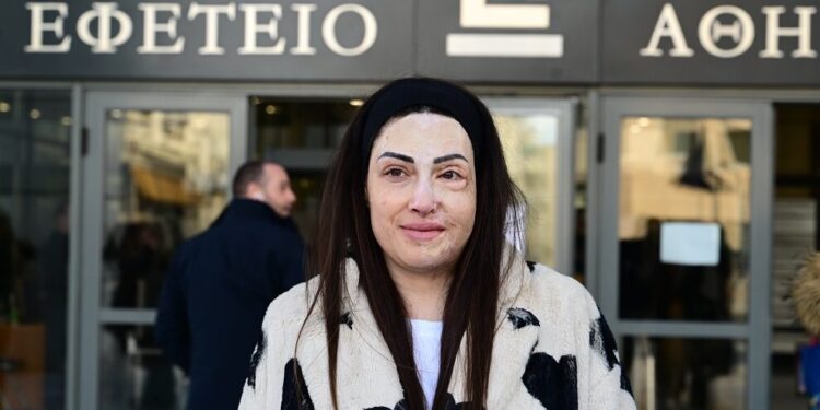 Ιωάννα Παλιοσπύρου: Ο φετινός χειμώνας θα είναι δύσκολος λόγω των θεραπειών που πρέπει να κάνω